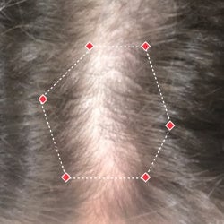 Top down view before image of a woman showing the widening part in her hairline.