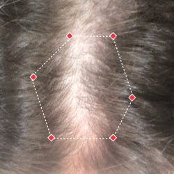 Top down view before image of a woman showing the widening part in her hairline.
