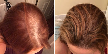 Hair Image