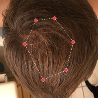 After Image of a man from top down view at crown with thicker hair.