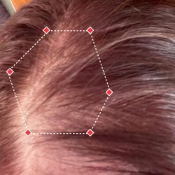 Top down view before image of a woman showing the thinning hair in her hairline.
