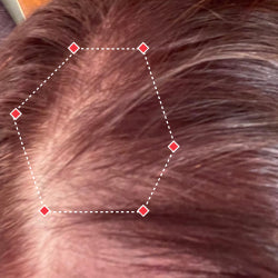 Top down view before image of a woman showing the thinning hair in her hairline.