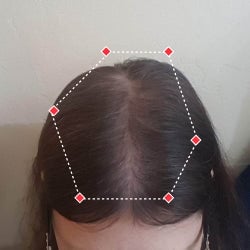 Top down view after image of a woman with thicker hair at the frontal region of her hair.
