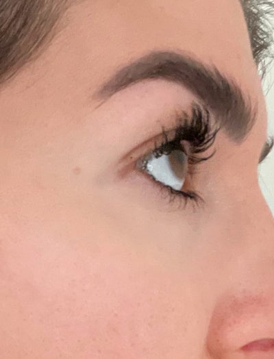 Close up shot of woman's eye area after using LED eye mask where improvements can be seen