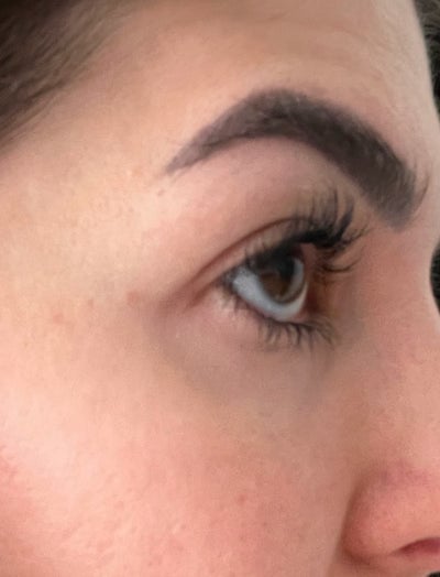 Close up shot of woman's eye area before using LED eye mask