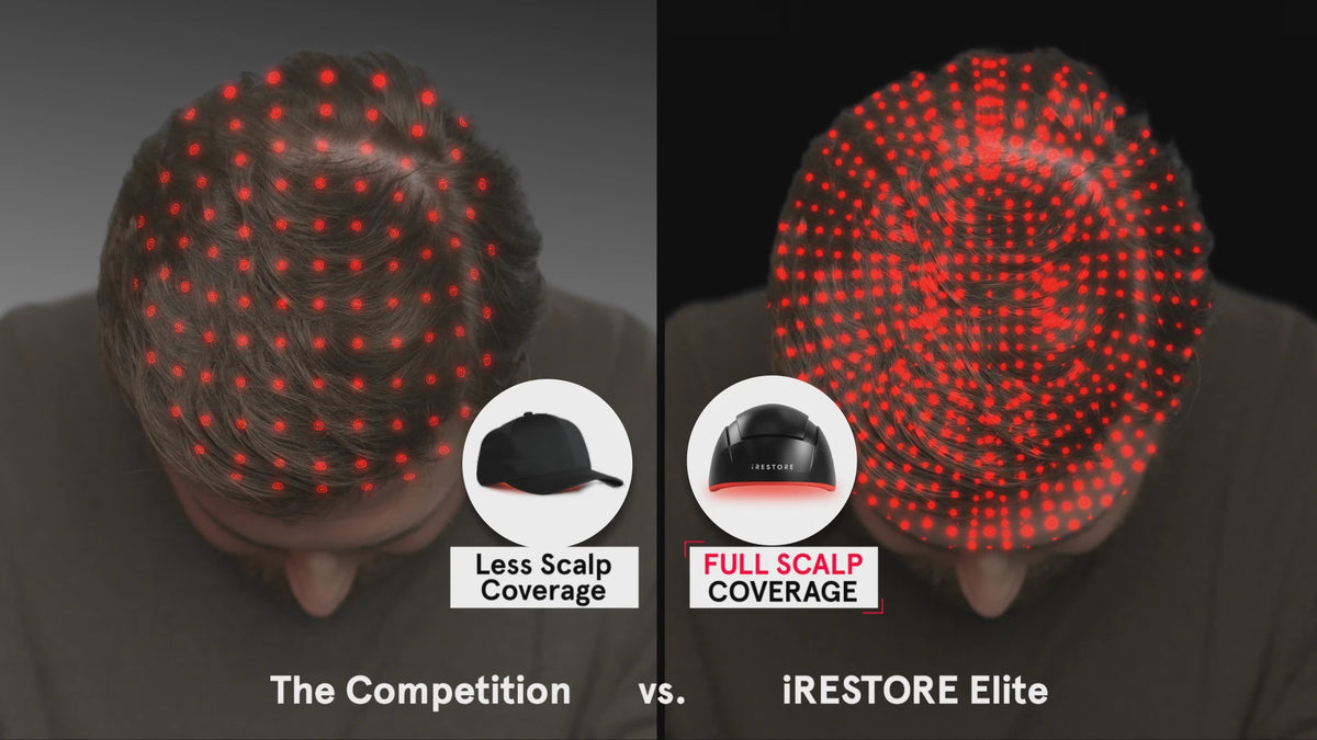 comparison of laser scalp coverage between competitors and iRESTORE
