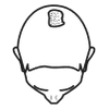 Image of Thinning Crown Example