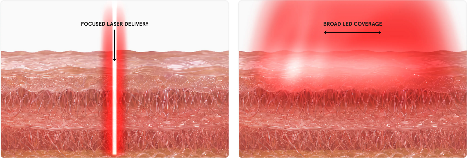 Diagram explaining 
