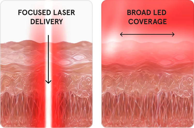 Diagram explaining 