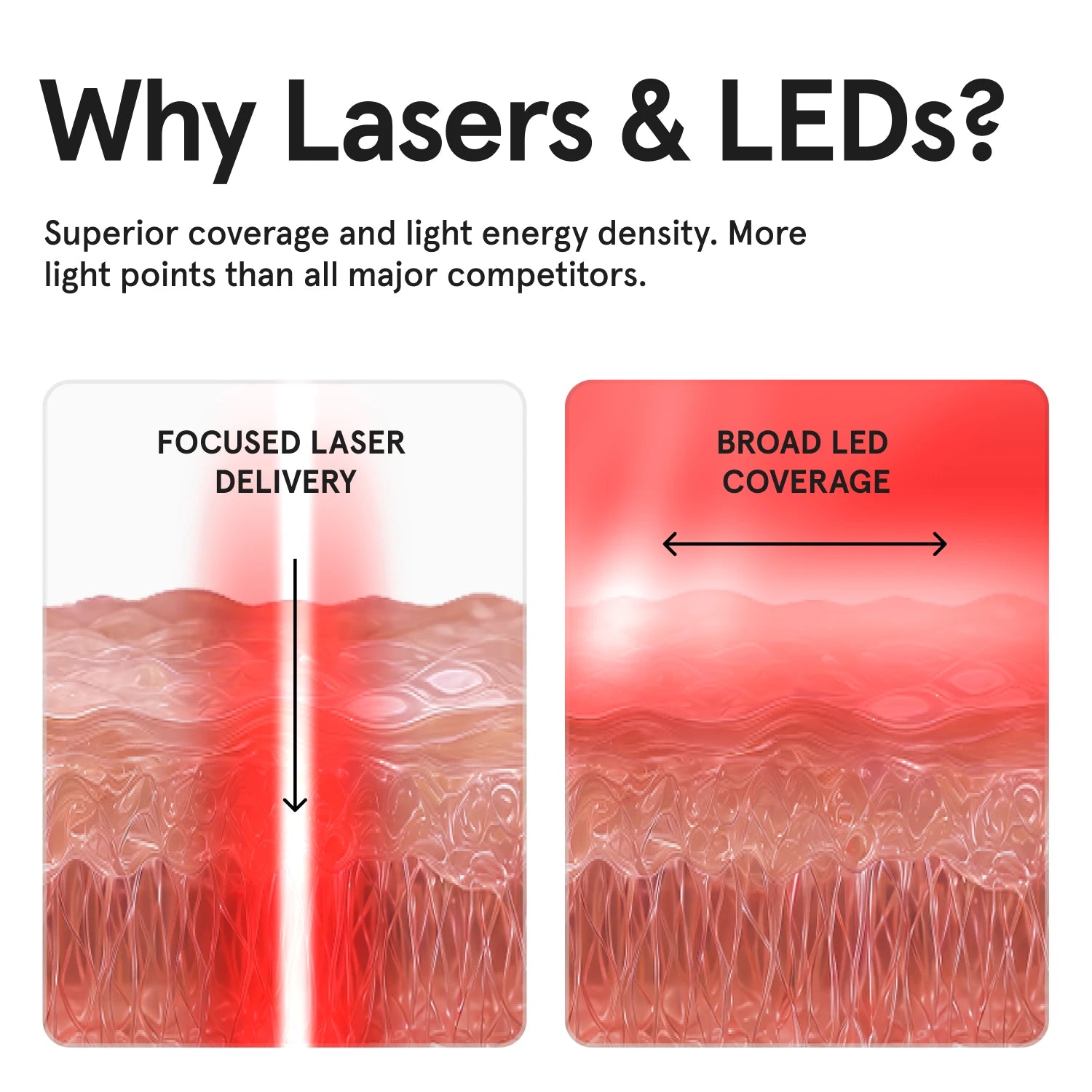 Diagram explaining "Why Lasers & LEDs?" comparing a concentrated red laser beam labeled "Lasers go Deep" on the left to a wide red LED beam labeled "LEDs cover Broadly" on the right.