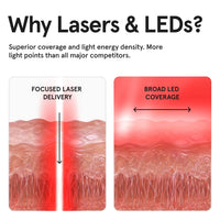 Diagram explaining "Why Lasers & LEDs?" comparing a concentrated red laser beam labeled "Lasers go Deep" on the left to a wide red LED beam labeled "LEDs cover Broadly" on the right.