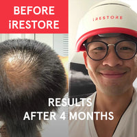 Man showcasing the iRESTORE essential hair device