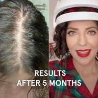 Woman showcasing the iRESTORE essential hair device