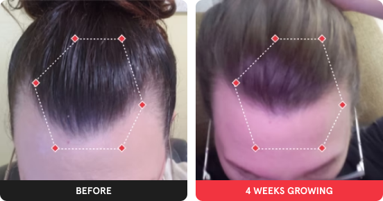 before and after showing significant hair growth