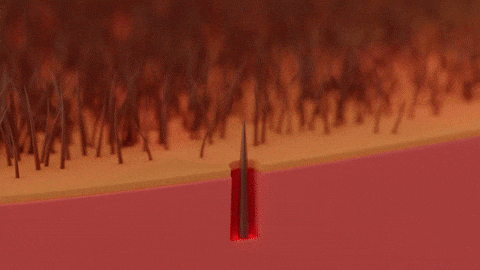Effects of laser on hair