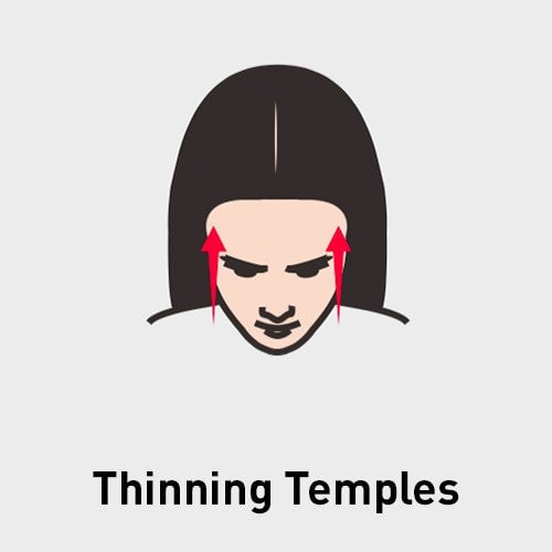 Thinning Temples