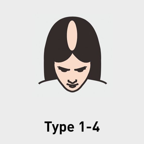Type 1-4