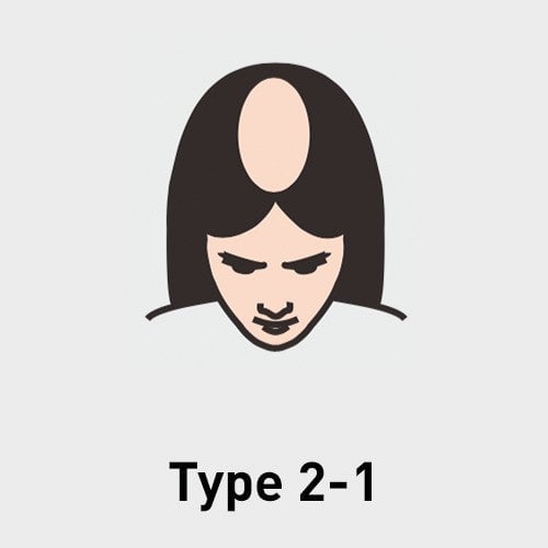 Type 2-1