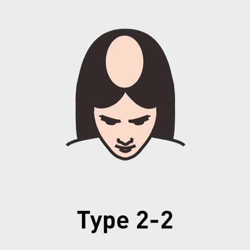 Type 2-2