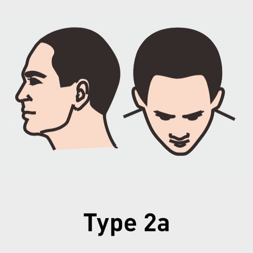 Type 2a