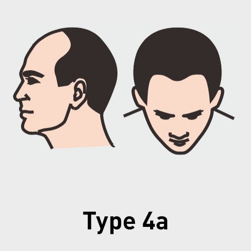 Type 4a